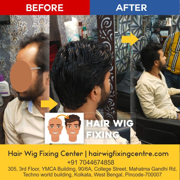 Hair Wig Fixing Centre
