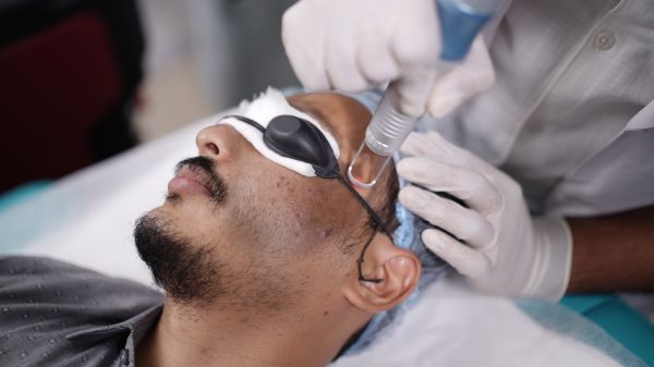 DermaVue Skin Lasers & Hair Transplant