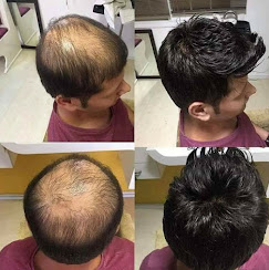 Hair Wig Fixing Centre