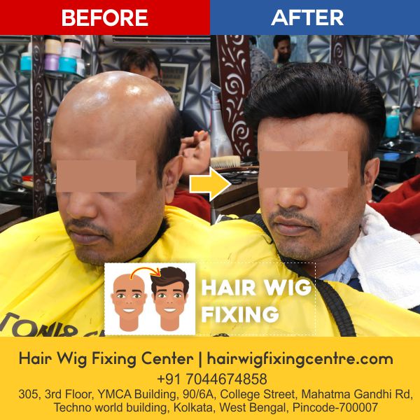 Hair Wig Fixing Centre